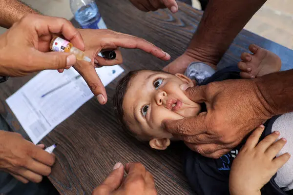 Polio Cases in Pakistan Number’sreach at 10