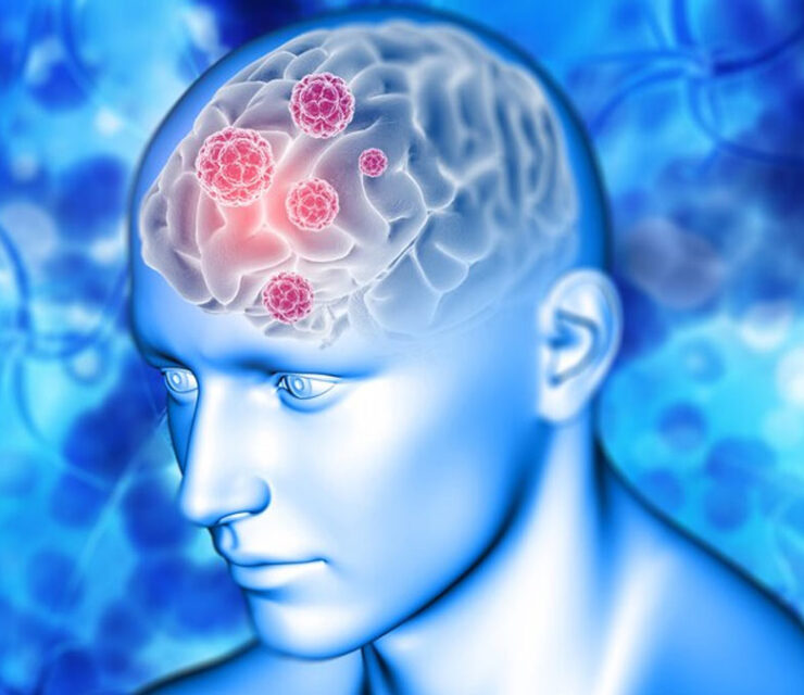 Innovative technology offersnon-invasive way to observe bloodclotting